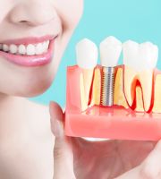 dental clinics in delhi Coral Dental - Best Dental Clinic In Delhi | Best Root Canal Treatment In Delhi