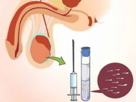 ovarian reserve analysis delhi Delhi IVF and Fertility Research Centre