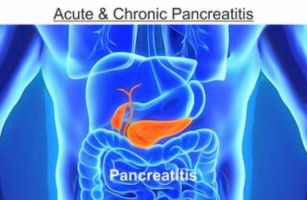 acute pancreatitis specialists delhi Dr Vikas Singla, Director and Head, Gastroenterology, Max Superspeciality Hospital, Best Gastroenterologist (Pancreas-Gall bladder, Esophagus, Cancer),