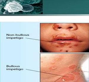 specialists bacterial diseases delhi Paediatric Skin Specialist/Dermatologist in Delhi