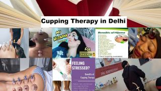 therapies for adults in delhi Cupping therapy in delhi