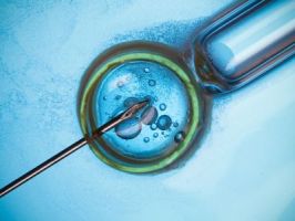 ovarian reserve analysis delhi Delhi IVF and Fertility Research Centre