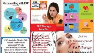 clinics prp platelet rich plasma in delhi Platelet Rich plasma (PRP) Treatment in Delhi