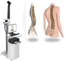 3D Formetric Posture Analysis System